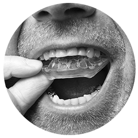 Bruxism Grinding Appliances | River Harmony Dental | General & Family Dentist | Cochrane | Alberta