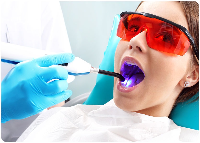 Cosmetic Dental Bonding | River Harmony Dental | General & Family Dentist | Cochrane | Alberta