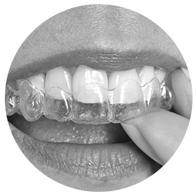 Invisalign | River Harmony Dental | General & Family Dentist | Cochrane | Alberta