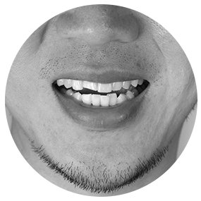 Orthodontics | River Harmony Dental | General & Family Dentist | Cochrane | Alberta