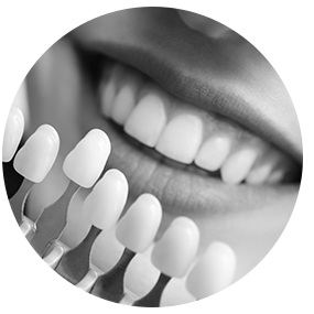 Porcelain Veneers | River Harmony Dental | General & Family Dentist | Cochrane | Alberta