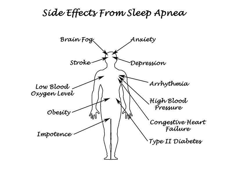 Sleep Apnea | Side Effects | River Harmony Dental | General & Family Dentist | Cochrane | Alberta