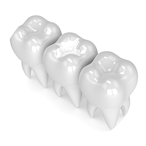 White Fillings | River Harmony Dental | General & Family Dentist | Cochrane | Alberta